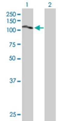 Western Blot: SLC20A2 Antibody [H00006575-B01P] - Analysis of SLC20A2 expression in transfected 293T cell line by SLC20A2 polyclonal antibody.  Lane 1: SLC20A2 transfected lysate(71.72 KDa). Lane 2: Non-transfected lysate.