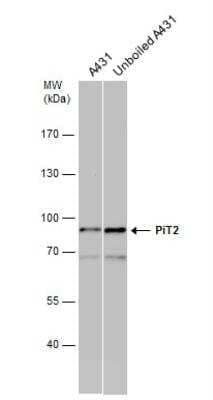 Western Blot: SLC20A2 Antibody [NBP1-32285] - A431 whole cell extracts (30 ug) were separated by 7.5% SDS-PAGE, and the membrane was blotted with PiT2 antibody [N2C1], Internal diluted at 1:500.