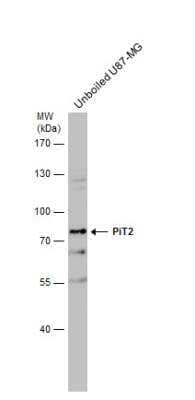 Western Blot: SLC20A2 Antibody [NBP1-32285] - Whole cell extract (30 ug) was separated by 7.5% SDS-PAGE, and the membrane was blotted with PiT2 antibody [N2C1], Internal diluted at 1:500.