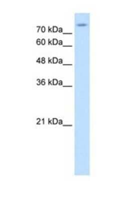 Western Blot: SLC20A2 Antibody [NBP1-69702] - This Anti-SLC20A2 antibody was used in Western Blot of HepG2 tissue lysate at a concentration of 1ug/ml.