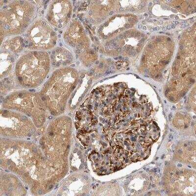 Immunohistochemistry: SLC22A1 Antibody [NBP1-89418] - Staining of human kidney shows moderate cytoplasmic positivity in cells in tubules and strong positivity in glomeruli.