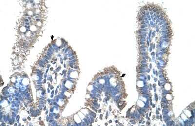 Immunohistochemistry-Paraffin: SLC22A1 Antibody [NBP1-59419] - Human Intestine Tissue, antibody concentration 4-8ug/ml. Cells with positive label: Epithelial cells of intestinal villus (indicated with arrows) 400X magnification.