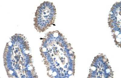 Immunohistochemistry-Paraffin: SLC22A1 Antibody [NBP1-59464] - Human Intestine Tissue, antibody concentration 4-8ug/ml. Cells with positive label: Epithelial cells of intestinal villus (indicated with arrows) 400X magnification.