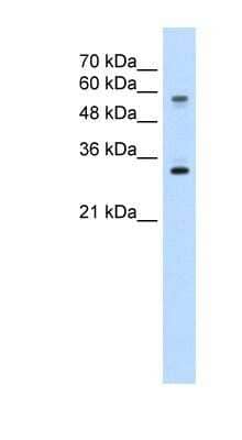 Western Blot: SLC22A1 Antibody [NBP1-59419] - HepG2 cell lysate, Antibody Titration: 5.0ug/ml