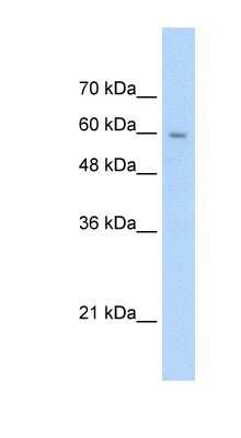 Western Blot: SLC22A1 Antibody [NBP1-59464] - Jurkat cell lysate, Antibody Titration: 2.5ug/ml