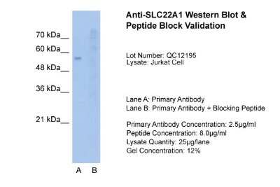 Western Blot: SLC22A1 Antibody [NBP1-59464] - Sample Tissue: Jurkat, Lane A: Primary Antibody, Lane B: Primary Antibody + Blocking Peptide, Primary Antibody Concentration: 2.5ug/mL, Peptide Concentration: 8.0ug/mL, Lysate Quantity: 25ug/lane, Gel Concentration: 12%