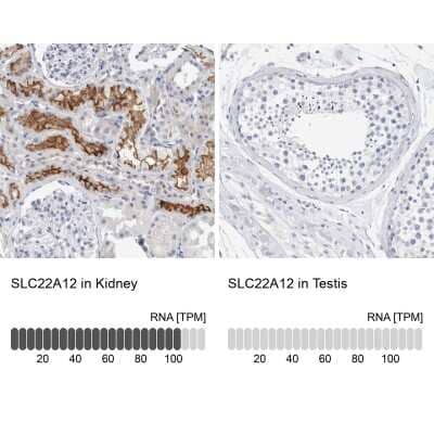 Immunohistochemistry-Paraffin SLC22A12 Antibody