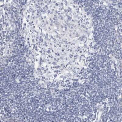 Immunohistochemistry-Paraffin: SLC22A12 Antibody [NBP1-82500] - Staining of human lymph node shows no positivity in lymphoid cells as expected.