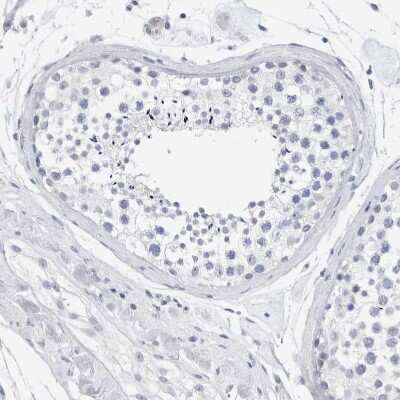 Immunohistochemistry-Paraffin: SLC22A12 Antibody [NBP1-82500] - Staining of human testis shows no positivity in cells in seminiferous ducts as expected.