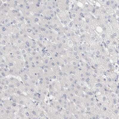 Immunohistochemistry-Paraffin: SLC22A12 Antibody [NBP1-82500] - Staining of human liver shows no positivity in hepatocytes as expected.