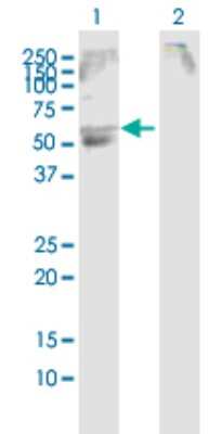 Western Blot: SLC22A12 Antibody [H00116085-D01P] - Analysis of SLC22A12 expression in transfected 293T cell line by SLC22A12 polyclonal antibody.Lane 1: SLC22A12 transfected lysate(59.60 KDa).Lane 2: Non-transfected lysate.
