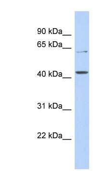 Western Blot SLC22A12 Antibody