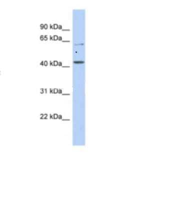 Western Blot: SLC22A12 Antibody [NBP1-69538] - WB Suggested Anti-SLC22A12 Antibody Titration: 0.2-1 ug/ml ELISA Titer: 1:62500 Positive Control: DU145 cell lysate