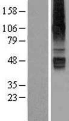 Western Blot SLC22A12 Overexpression Lysate