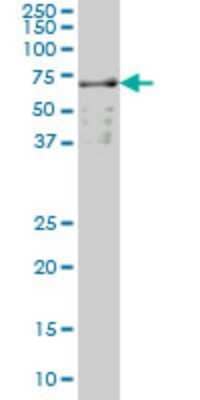 Western Blot: SLC22A13 Antibody (1E6) [H00009390-M01] - SLC22A13 monoclonal antibody (M01), clone 1E6 Analysis of SLC22A13 expression in A-431.