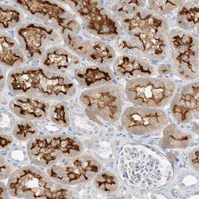 Immunohistochemistry-Paraffin: SLC22A13 Antibody [NBP2-32712] - Staining of human kidney shows strong membranous positivity in cells in tubules.