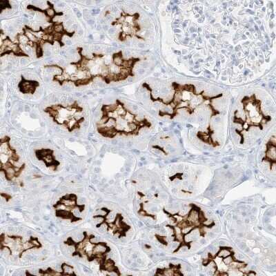 Immunohistochemistry-Paraffin: SLC22A13 Antibody [NBP1-82502] - Staining of human kidney shows high expression.