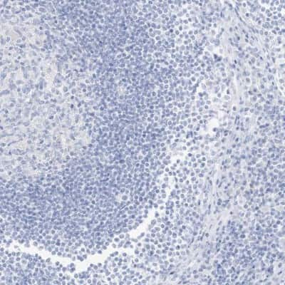 Immunohistochemistry-Paraffin: SLC22A13 Antibody [NBP1-82502] - Staining of human lymph node shows low expression as expected.