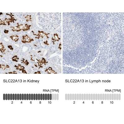 <b>Orthogonal Strategies Validation. </b>Immunohistochemistry-Paraffin: SLC22A13 Antibody [NBP1-82502] - Staining in human kidney and lymph node tissues using anti-SLC22A13 antibody. Corresponding SLC22A13 RNA-seq data are presented for the same tissues.