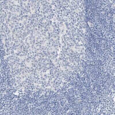 <b>Orthogonal Strategies Validation. </b>Immunohistochemistry-Paraffin: SLC22A13 Antibody [NBP2-32712] - Staining of human lymph node shows low expression as expected.