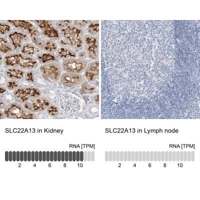 Immunohistochemistry-Paraffin: SLC22A13 Antibody [NBP2-32712] - Staining in human kidney and lymph node tissues using anti-SLC22A13 antibody. Corresponding SLC22A13 RNA-seq data are presented for the same tissues.