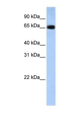 Western Blot: SLC22A13 Antibody [NBP1-62520] - Human Placenta lysate, concentration 0.2-1 ug/ml.