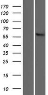 Western Blot: SLC22A13 Overexpression Lysate (Adult Normal) [NBP2-07894] Left-Empty vector transfected control cell lysate (HEK293 cell lysate); Right -Over-expression Lysate for SLC22A13.