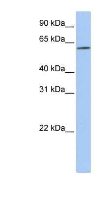 Western Blot: SLC22A14 Antibody [NBP1-59398] - Titration: 0.2-1 ug/ml, Positive Control: MCF7 cell lysate.