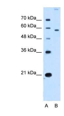 Western Blot: SLC22A2 Antibody [NBP1-59451] - HepG2 cell lysate, concentration 2.5 ug/ml.