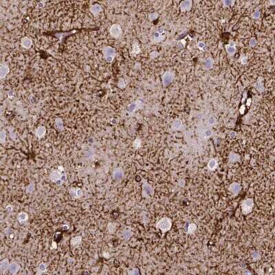 Immunohistochemistry-Paraffin: SLC22A2/OCT2 Antibody (CL0631) [NBP2-52942] - Staining of human cerebral cortex shows strong membranous positivity in astrocytes.