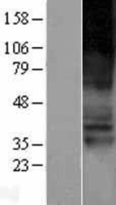 Western Blot: SLC22A4 Overexpression Lysate (Adult Normal) [NBP2-04242] Left-Empty vector transfected control cell lysate (HEK293 cell lysate); Right -Over-expression Lysate for SLC22A4.