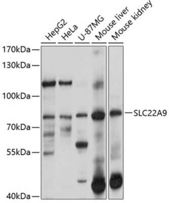 Western Blot: SLC22A9 Antibody [NBP2-94143] - Analysis of extracts of various cell lines, using SLC22A9 at 1:1000 dilution. Secondary antibody: HRP Goat Anti-Rabbit IgG (H+L) at 1:10000 dilution. Lysates/proteins: 25ug per lane. Blocking buffer: 3% nonfat dry milk in TBST. Detection: ECL Basic Kit . Exposure time: 10s.