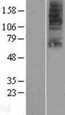 Western Blot: SLC22A9 Overexpression Lysate (Adult Normal) [NBP2-05754] Left-Empty vector transfected control cell lysate (HEK293 cell lysate); Right -Over-expression Lysate for SLC22A9.