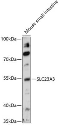 Western Blot: SLC23A3 Antibody [NBP2-95153] - Analysis of extracts of mouse small intestine, using SLC23A3 at 1:1000 dilution.Secondary antibody: HRP Goat Anti-Rabbit IgG (H+L) at 1:10000 dilution.Lysates/proteins: 25ug per lane.Blocking buffer: 3% nonfat dry milk in TBST.Detection: ECL Basic Kit .Exposure time: 90s.
