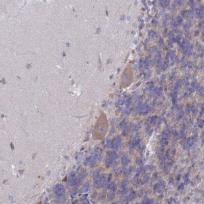 Immunohistochemistry-Paraffin: SLC24A3 Antibody [NBP2-31010] - Staining of human cerebellum shows cytoplasmic positivity in Purkinje cells.