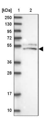 Western Blot: SLC24A3 Antibody [NBP2-31010] - Lane 1: Marker [kDa] 250, 130, 95, 72, 55, 36, 28, 17, 10Lane 2: Human cell line RT-4