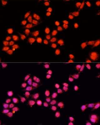 Immunocytochemistry/ Immunofluorescence SLC24A5 Antibody - Azide and BSA Free