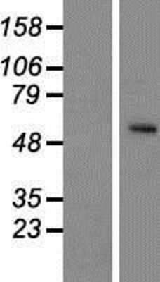 Western Blot: SLC24A5 Overexpression Lysate (Adult Normal) [NBP2-04531] Left-Empty vector transfected control cell lysate (HEK293 cell lysate); Right -Over-expression Lysate for SLC24A5.