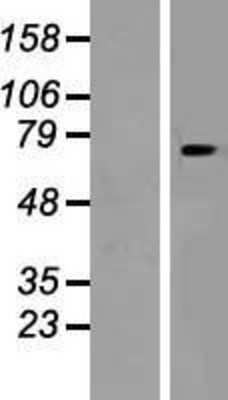 Western Blot SLC24A6 Overexpression Lysate