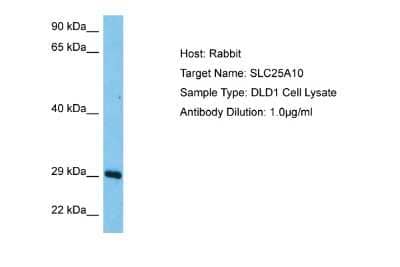 Western Blot: SLC25A10 Antibody [NBP2-83542] - Host: Rabbit. Target Name: SLC25A10. Sample Tissue: Human DLD1 Whole Cell lysates. Antibody Dilution: 1ug/ml