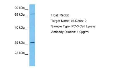 Western Blot: SLC25A10 Antibody [NBP2-83543] - Host: Rabbit. Target Name: SLC25A10. Sample Tissue: Human PC-3 Whole Cell lysates. Antibody Dilution: 1ug/ml