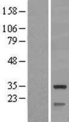 Western Blot: SLC25A10 Overexpression Lysate (Adult Normal) [NBL1-16046] Left-Empty vector transfected control cell lysate (HEK293 cell lysate); Right -Over-expression Lysate for SLC25A10.