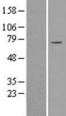 Western Blot: SLC25A12 Overexpression Lysate (Adult Normal) [NBL1-16048] Left-Empty vector transfected control cell lysate (HEK293 cell lysate); Right -Over-expression Lysate for SLC25A12.