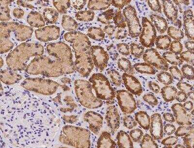 Immunohistochemistry-Paraffin: SLC25A15 Antibody [NBP3-12684] - Staining of human SLC25A15 in human kidney with rabbit polyclonal antibody at 1:300 dilution.