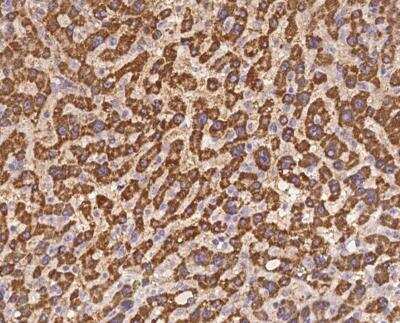 Immunohistochemistry-Paraffin: SLC25A15 Antibody [NBP3-12684] - Staining of human SLC25A15 in human liver with rabbit polyclonal antibody at 1:300 dilution.