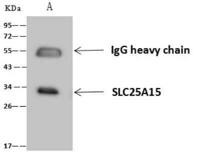 Immunoprecipitation: SLC25A15 Antibody [NBP3-12684] - Lane A:0.5 mg mouse liver Whole Cell Lysate4 uL anti-SLC25A15 rabbit polyclonal antibody and 60 ug of Immunomagnetic beads Protein A/G.Primary antibody:Anti-SLC25A15 rabbit polyclonal antibody,at 1:100 dilution Secondary antibody:Goat Anti-Rabbit IgG (H+L)/HRP at 1/10000 dilutionDeveloped using the ECL technique.Performed under reducing conditions.Predicted band size: 32 kDaObserved band size :32 kDa