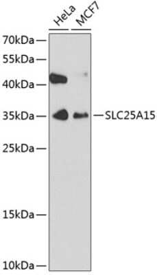 Western Blot: SLC25A15 Antibody [NBP2-94891] - Analysis of extracts of various cell lines, using SLC25A15 . Exposure time: 30s.