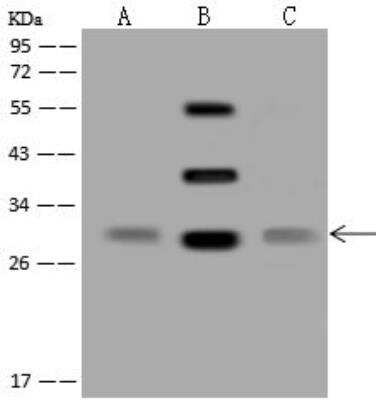 Western Blot: SLC25A15 Antibody [NBP3-12684] - Lane A: Raji Whole Cell LysateLane B: Mouse liver tissue lysate Whole Cell LysateLane C: U-251MG Whole Cell LysateLysates/proteins at 30 ug per lane.SecondaryGoat Anti-Rabbit IgG (H+L)/HRP at 1/10000 dilution.Developed using the ECL technique.Performed under reducing conditions.Predicted band size:32 kDaObserved band size:32 kDa(We are unsure as to the identity of these extra bands.)