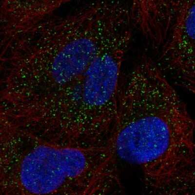 Immunocytochemistry/Immunofluorescence: SLC25A17 Antibody [NBP2-56442] - Staining of human cell line U-2 OS shows localization to peroxisomes.