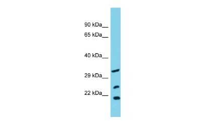 Western Blot: SLC25A17 Antibody [NBP2-88253] - Host: Rabbit. Target Name: SLC25A17. Sample Type: OVCAR-3 Whole Cell lysates. Antibody Dilution: 1.0ug/ml